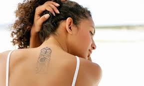 $200 $2,000 based on 8 community reviews. Sugar Land Laser Tattoo Removal Up To 90 Off Sugar Land Tx Groupon