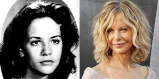 Meg ryan plastic surgery before after. Has Meg Ryan Had Plastic Surgery Face Before And After
