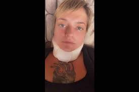 Fundraiser by Rose Hart : Rose needs neck reconstructive surgery