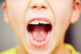 How do i know if my teeth are crooked? Is It Necessary To Treat Crowded And Crooked Teeth Dentist In Santa Rosa