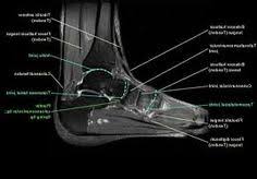 The extrinsic muscles are located in the anterior and lateral compartments of the leg. 50 Mri Ideas Mri Radiology Radiography