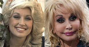 The Rise Of The Pillow Face Bad Celebrity Plastic Surgery Bad Plastic Surgeries Plastic Surgery