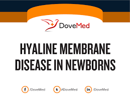 Hyaline Membrane Disease In Newborns