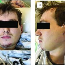 Shawna Morrissey's research works