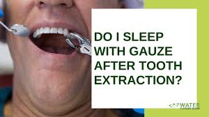 Depending on the extent of bruising and the patient's pain tolerance levels,. Do I Sleep With Gauze After Tooth Extraction Youtube