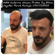 Ozguller Akademi Adli Kullanicinin Ozguller Peruk Panosundaki Pin