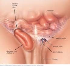 Testicular cancer can cause pain. Scrotal Masses Symptoms And Causes Mayo Clinic