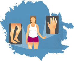 Image result for Systemic Sclerosis