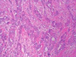 Weigh and measure in 3 dimensions. Pathology Of Tissues Confirmed Malignant Pleural Mesothelioma Mpm Download Scientific Diagram