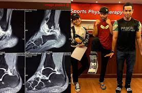 Faralyna idris, azlee khairi, shah iskandar, intan ladyana, dato' eizlan yusoff, fazlina ahmad daud fira ayuni. Myartis Com Myartis My Artis Ligamen Kaki Hairul Azreen Koyak Ketika Buat Stunt Filem Wira