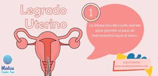 Legrado Uterino Medica Center Fem
