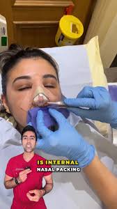 Image result for Nasal Packing