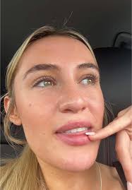 Bethany Webster: Scouse Accent Rant