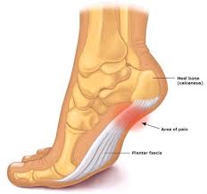 Pain on the top of foot is a common symptom of. An Overview Of Tendonitis For Hikers Trailside Fitness