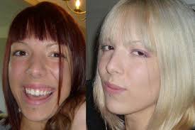 How To Remove Hair Dye Using Vitamin C Hair Dye Removal Hair Color Remover Dark Hair Dye