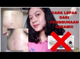 Maybe you would like to learn more about one of these? Korban Cream Pemutih Berbahaya Dan Cara Mengatasinya Youtube