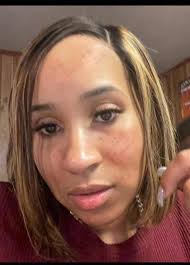 Dryness? Breakouts? Fine lines? Sensitivity? Girl, we've got you! 💖