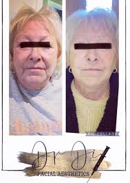 Dr Di Facial Aesthetics
