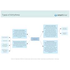 Types Of Arrhythmia