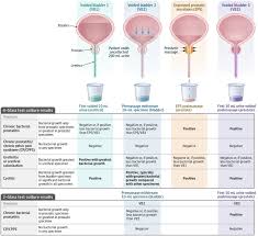 Image result for Chronic Bacterial Prostatitis