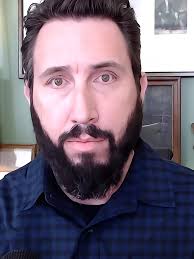 Darly Sanchez Amputee