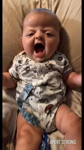 Bennett Reed & Apert Syndrome