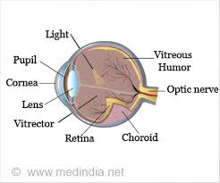 Vitrectomy is sometimes necessary in conjunction with retinal detachment surgery to reattach a torn retina. Vitrectomy Surgery Types Indications Procedure Complications