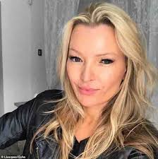 When people look at Denise's face, she thinks they're looking at her scars  from a horrific car crash. In fact they're thinking: Is that Kate Moss!