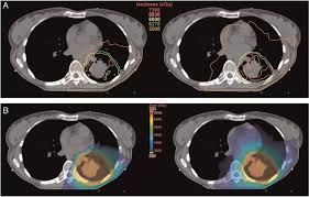 One million us manufacturers, wholesale, resellers, contractors, and service companies lists within 30,000 product & service supply categories. Pathways To Improving Combined Modality Therapy For Stage Iii Nonsmall Cell Lung Cancer Annals Of Oncology