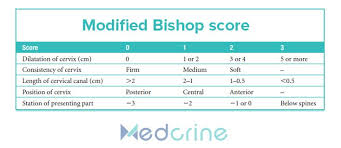 Image result for Bishop Score