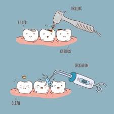 Teeth Treatment And Care Dental Jokes Dental Fun Dentist Humor
