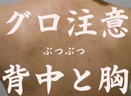 トラブル ダーマローラー使いまわしは危険 私が感じた違和感と消毒方法 汚肌改善ジャーナル ニキビ ダーマローラー ヘアケアグッズ