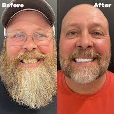 Top Smile Restoration Kyle TX
