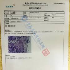全球员工近万人，其中研发人员占比超过 20%，外籍员工超过 12%，来自全球 30 多个国家及地区，形成了庞大的全球研发、营销和服务网络。 迈瑞的主营业务覆盖生命信息与支持、体外诊断、医学影像三大领域，通过前沿技术创新. èƒƒç–¼åˆ°èƒƒç™Œéœ€è¦å¤šé•¿çš„æ—¶é—´å'¢ ä¸€ä¸ªä¸­è€å¹´æ‚£è€…çš„èƒƒé•œ