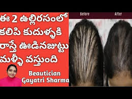 Hair loss treatment :this powerful remedy protects and nourishes hair. à°‰à°² à°² à°ª à°¯à°¤ à°Šà°¡ à°¨ à°œ à°Ÿ à°Ÿ à°®à°³ à°³ à°µà°¸ à°¤ à°¦ Onion Oil For Hair Growth In Telugu Onion Juice For Hairgrowth