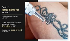 The 532 nm wavelength is highly effective for removing red. Tattoo Removal Market Size Industry Forecast By 2027