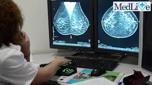 Un computer tomograf poate fi folosit pentru a studia orice zona a corpului si a membrelor. Mamografie Digitala Cu Tomosinteza Medlife