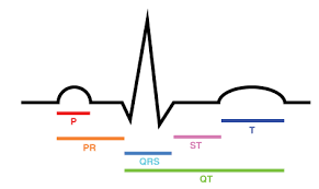 Download File Ecg Intervals Svg Wikipedia