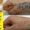 Is it possible to remove tattoo at home? 1