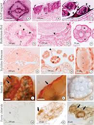 Image result for Tricalysia semidecidua
