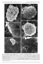 Image result for Exotheca