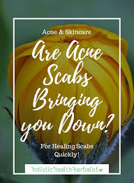 Don't touch, pick, squeeze, or scratch the affected area. Acne Scabs Bringing You Down Holistic Health Herbalist