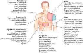 Chest Pain Icd 10 Code Guidelines And Examples
