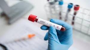 Virus imunodefisiensi manusia (bahasa inggris: Viral Kasus Vina Garut Waspadai Gejala Hiv Pada Pria