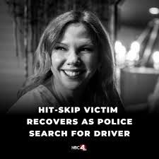 An Ohio woman is fighting broken bones and brain injuries after she was hit  by a car after attending Buckeye Country Superfest last Saturday.  https://nbc4i.co/446le6G?utm_medium=social&utm_source=facebook_NBC4