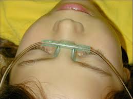 Image result for Eye Irrigation
