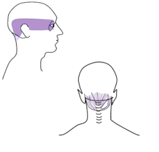 Image result for Eye Pain