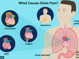 Here's what the experts say. How Do You Tell If Chest Pain Is A Serious Emergency