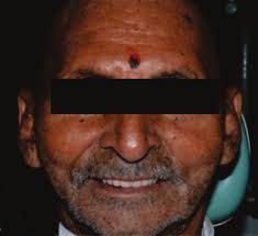 Dr. Nidhi Beria* Dr. Rajeev Singh Dr. Asha M. Rathod Dr. Gaurang Mistry Dr.  Charusheela Sardar INTERNATIONAL JOURNAL OF SCIENTIF