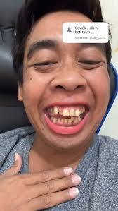 Mimi Peri Rapunchelle